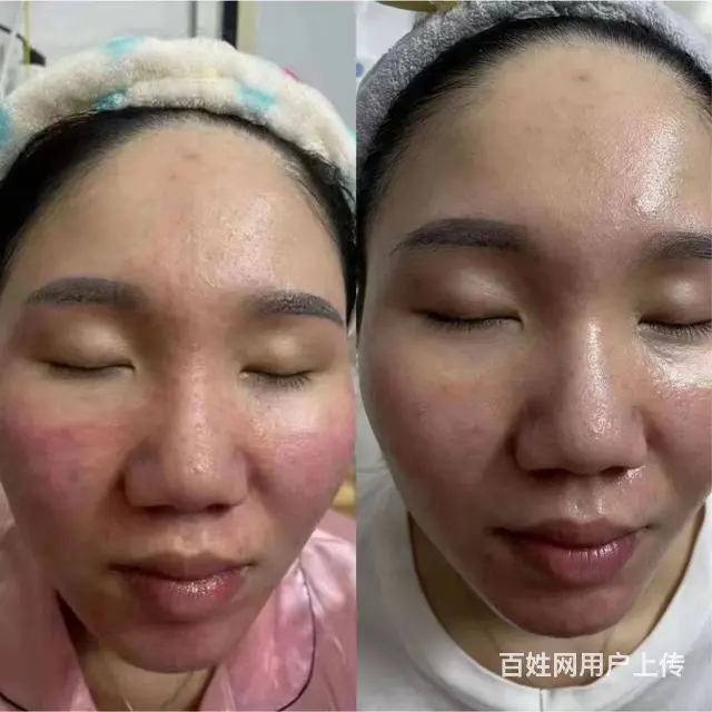 施洛贝缇珍珠膏代理价怎么拿 - 图片 10