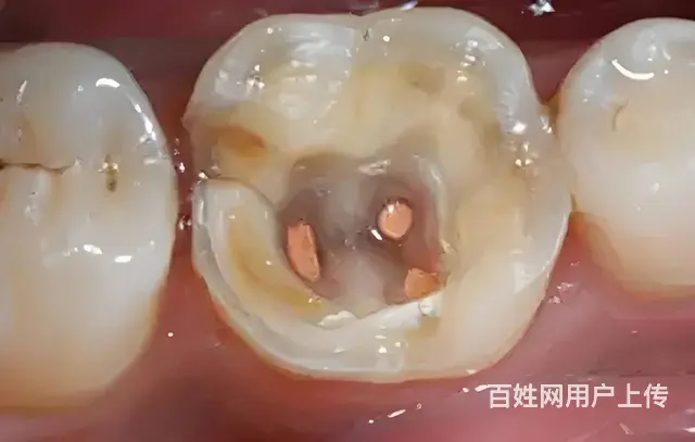 哈尔滨根管  的专科医院 - 图片 1