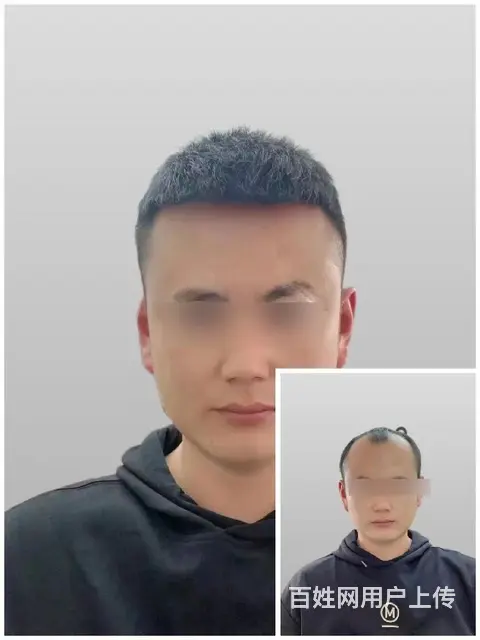 南召中年男士假发隐形补发中心电话,性价比高 - 图片 1