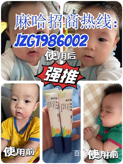 戒之馆婴儿护臀膏 宝宝“红臀”无所畏 - 图片 3