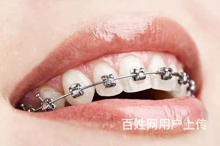 哈尔滨牙齿矫正去哪个诊所比较好 - 图片 1