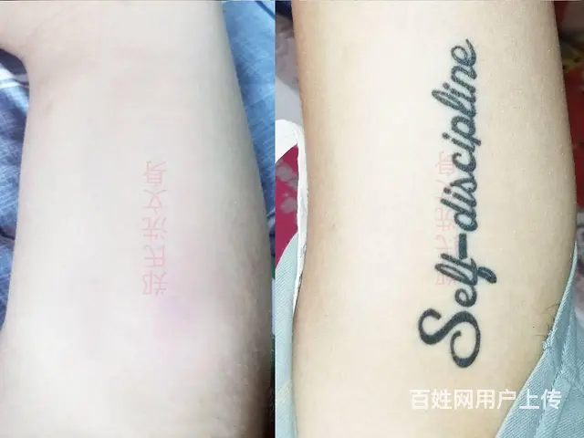 洗不掉的纹身就到郑氏洗纹身工作室 - 图片 8
