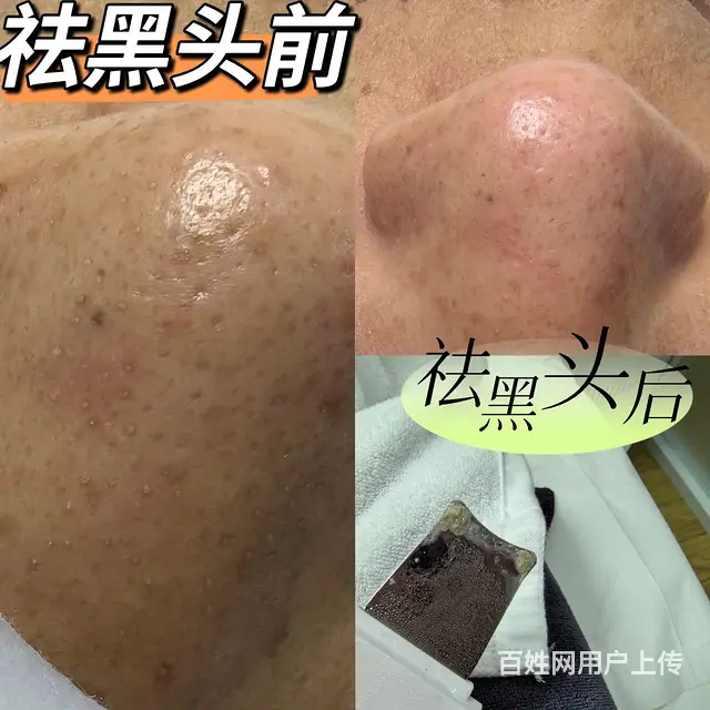 美容护肤 - 图片 7