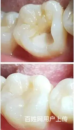 哈尔滨补牙选择哪家诊所 - 图片 1