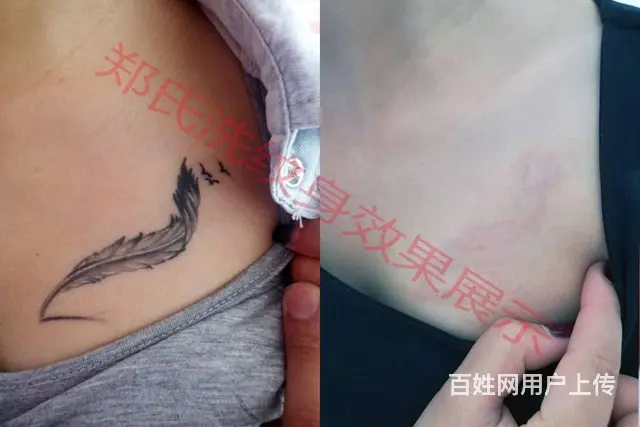 洗纹身就到辽阳郑氏洗纹身专洗别处洗不掉的所有纹身 - 图片 10