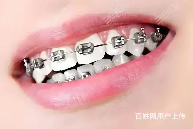 哈尔滨牙齿矫正去哪个诊所比较好 - 图片 2