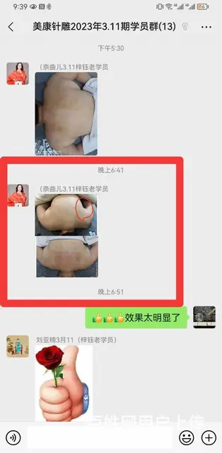 杭州美康针灸美雕 298报名学习 - 图片 1