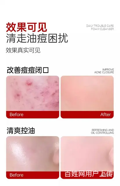 秀肤生水杨酸净肤洗面奶批发代理一件代发 - 图片 12