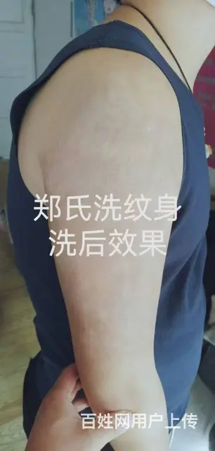 小伙子彩色纹身的洗净之路 - 图片 4