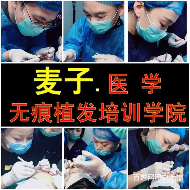 绍兴植发培训班多少费用，绍兴毛发移植培训技术班 - 图片 2