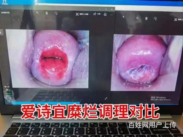 吉林市私密疗愈全国免费培训 - 图片 1