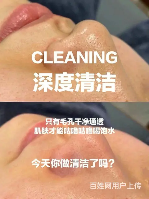 美容护肤 - 图片 6