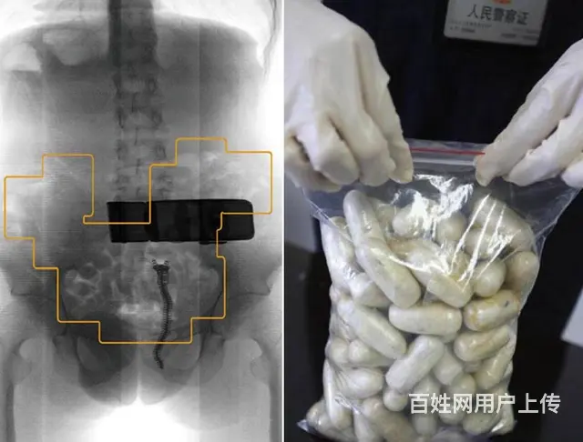 安徽启路达人体腹部检测安检机 腹部藏毒检测设备 - 图片 1