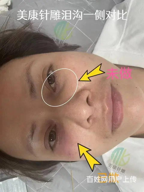 合肥美康针灸美雕 试学体验报名中 - 图片 1