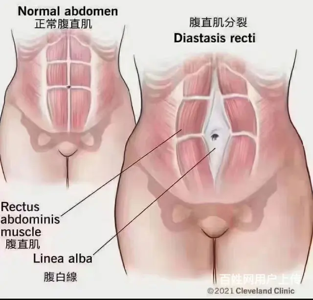 惠阳大亚湾区专业产后收窄耻骨骨盘 修复盘底肌解决漏 - 图片 4