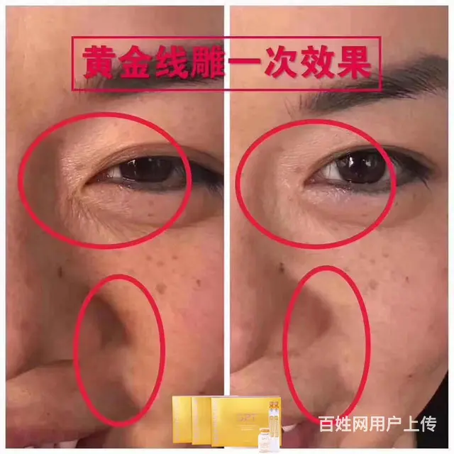 gpt黄金线雕全国招商 - 图片 7
